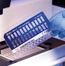 Microfluidic Diagnostics