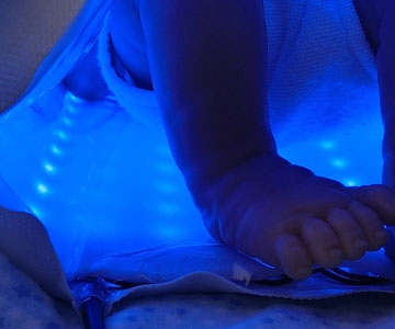 Phototherapy/Jaundice Device